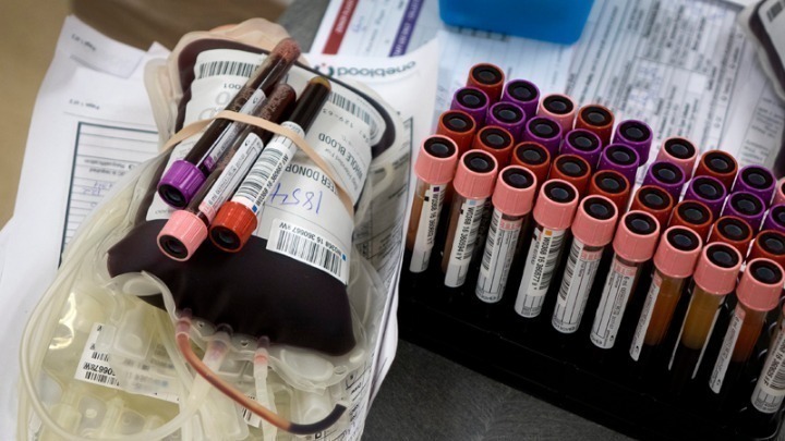 Ανησυχία από τη μείωση της αιμοδοσίας κατά τη διάρκεια της πανδημίας – Έκκληση για εθελοντική προσφορά
